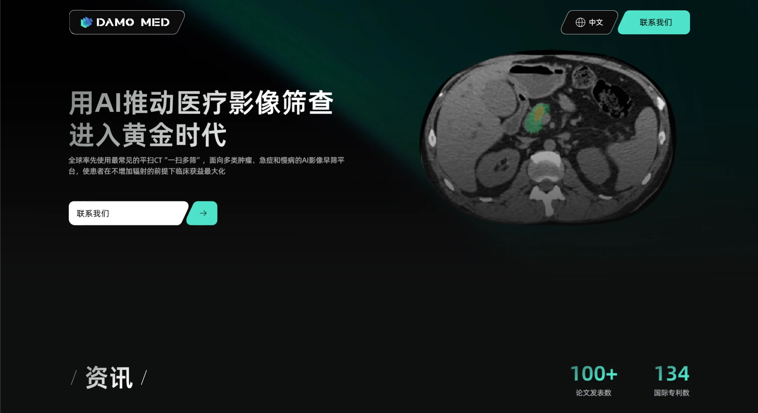 达医智影：阿里巴巴达摩院医疗AI实验室自研的智能读片产品.webp